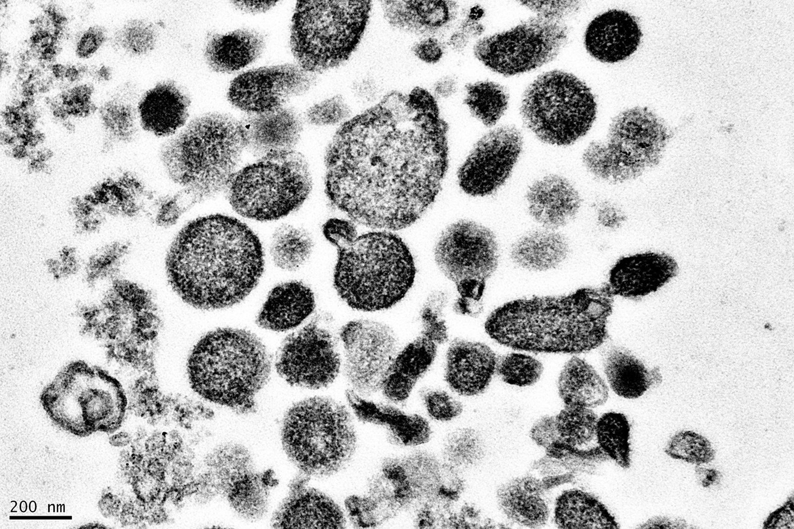 Norris-extracellular-vesicle-image.jpg